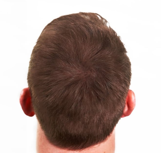 Tjeme i kruna, 30 sekundi nakon nanošenja keratinskih vlakana